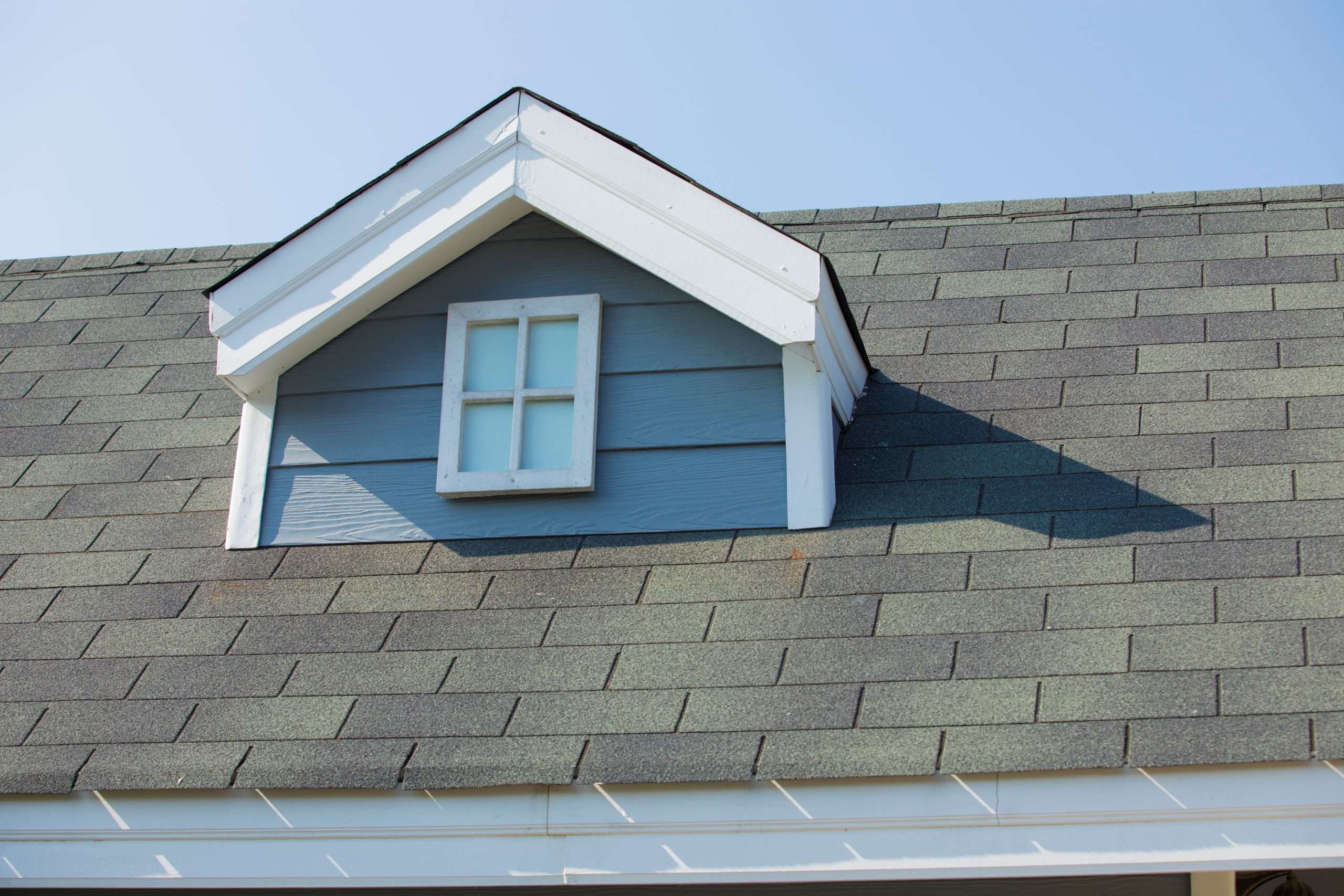 Shingles
